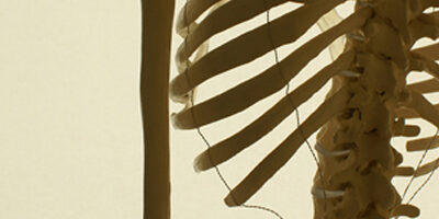 acupuncture at balham osteopathy